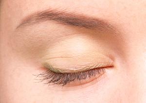 魚の目をレーザー治療で取り除ける病院